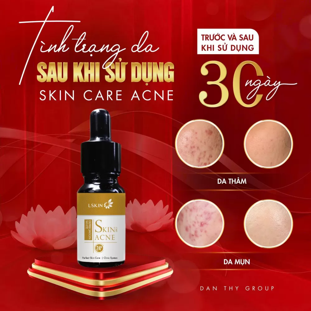 Trước và sau khi sử dụng cốt mụn Bạch Sen Đan Thy Trước và sau khi sử dụng cốt mụn Bạch Sen Đan Thy