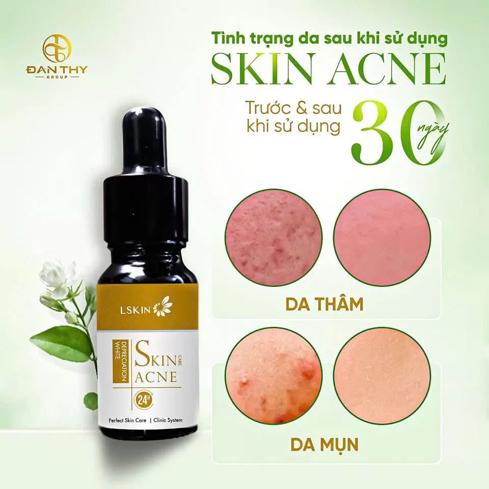 Cốt Mụn Bạch Sen LSkin Đan Thy 10ml